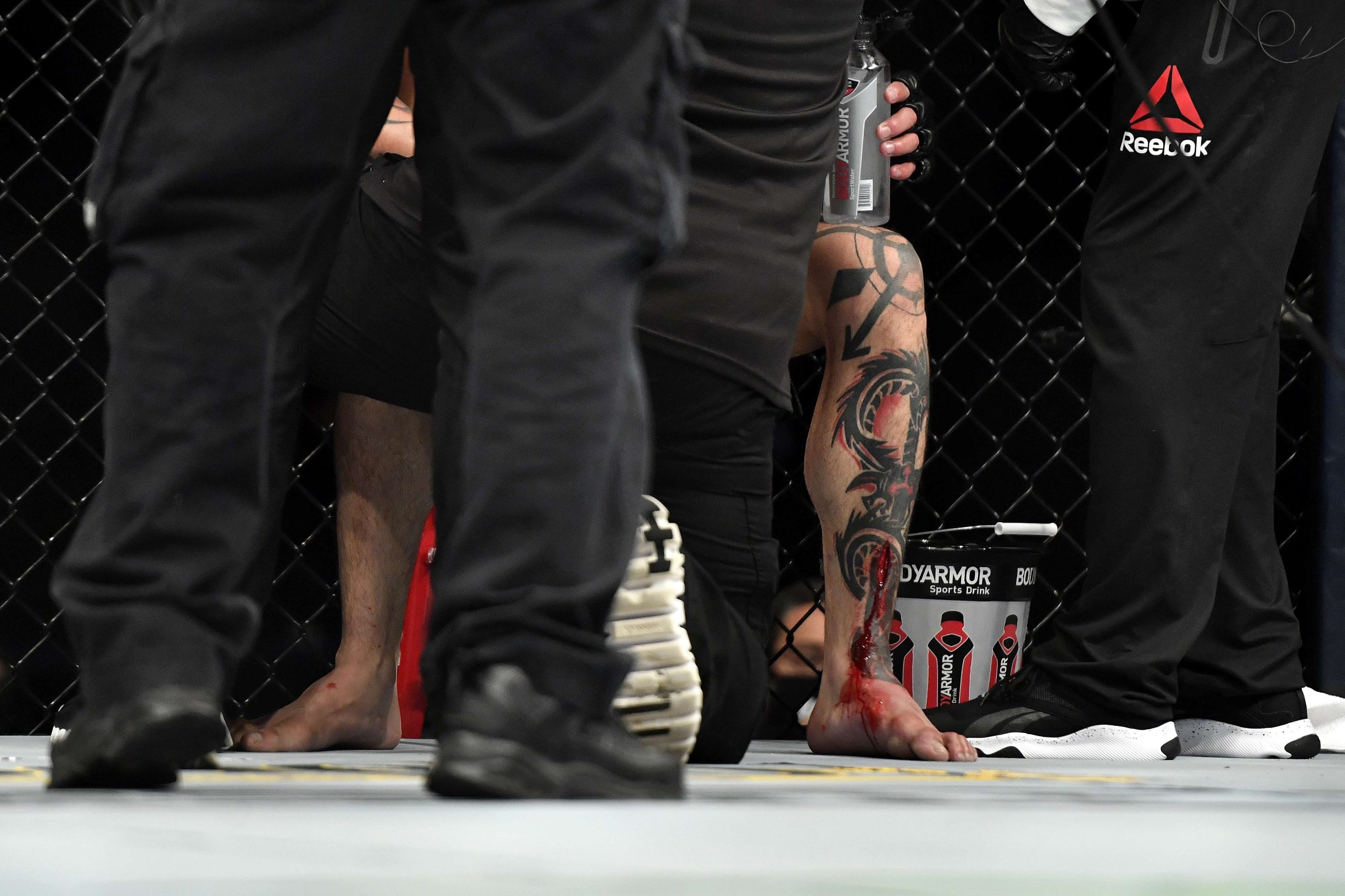 JACKSONVILLE, FLORIDA - MAY 13: A detailed view of a cut on the leg of Omar Antonio Morales Ferrer of Venezuela as he sits down during a break in his Lightweight bout against Gabriel Benitez of Mexico during UFC Fight Night at VyStar Veterans Memorial Arena on May 13, 2020 in Jacksonville, Florida.   Douglas P. DeFelice/Getty Images/AFP
== FOR NEWSPAPERS, INTERNET, TELCOS & TELEVISION USE ONLY ==
